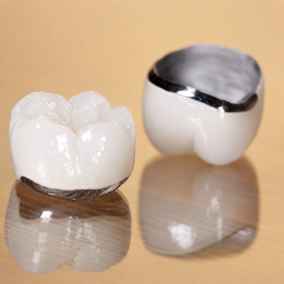 Răng Sứ Chrome Cobalt