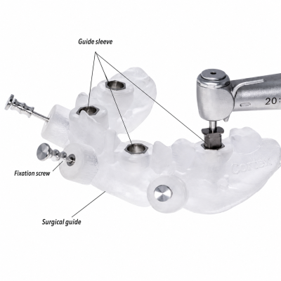 Implant Surgical Guide