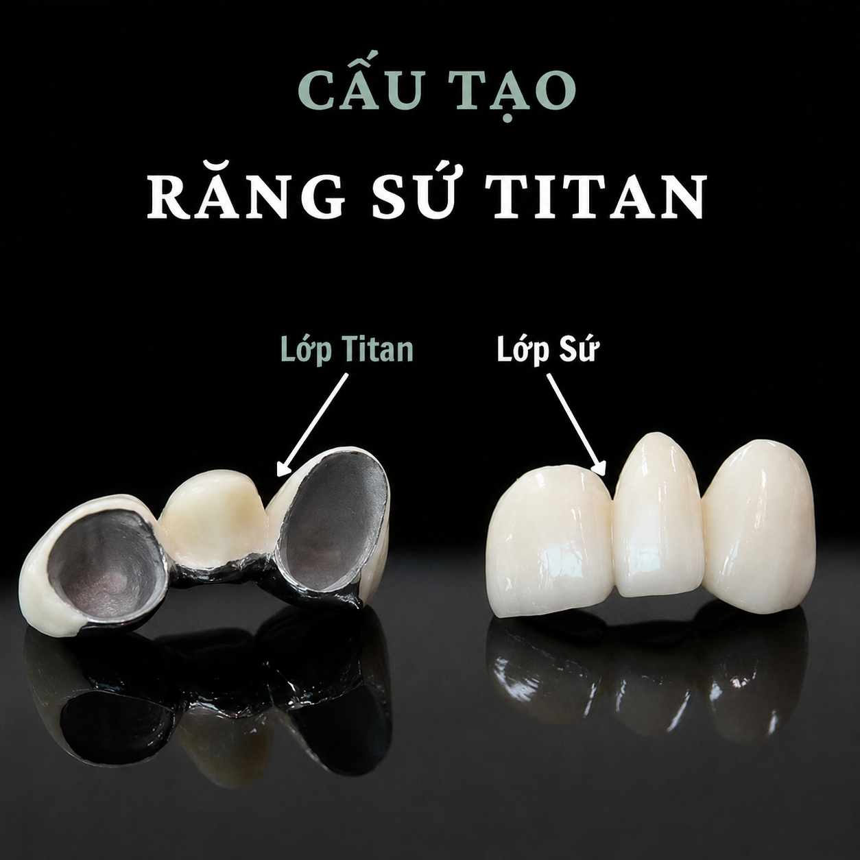 Răng Sứ TiTan - Ảnh 3