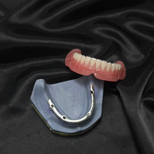THANH BAR TRÊN IMPLANT - Ảnh 3
